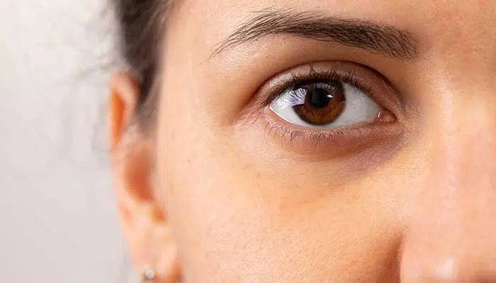 Comment soigner les yeux secs naturellement ?